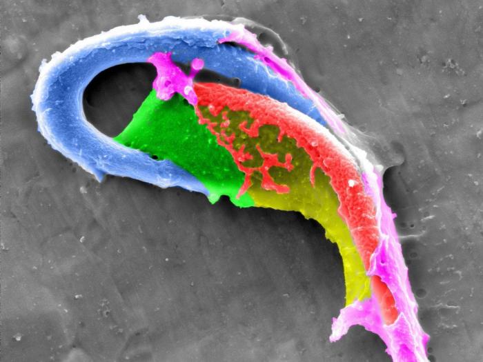 Al microscopio: insectos y otras 'maravillas' (FOTOS)