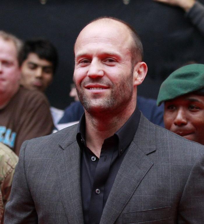 ¿Por qué a ellos les preocupa tanto el pelo?