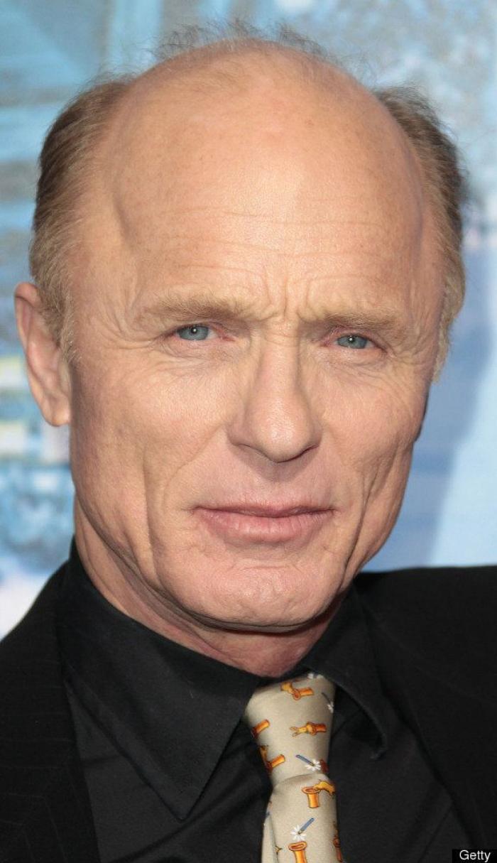 ¿Por qué a ellos les preocupa tanto el pelo?