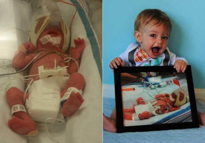 Estos peluches están cambiando la vida de los bebés prematuros