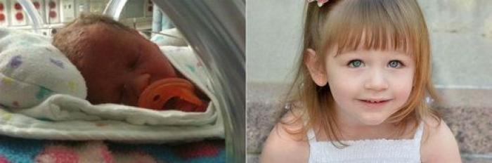 Estos peluches están cambiando la vida de los bebés prematuros