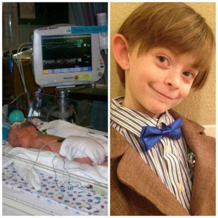 Estos peluches están cambiando la vida de los bebés prematuros