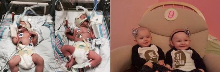 Estos peluches están cambiando la vida de los bebés prematuros