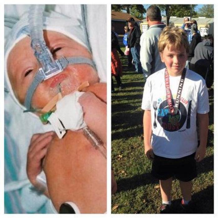 Estos peluches están cambiando la vida de los bebés prematuros