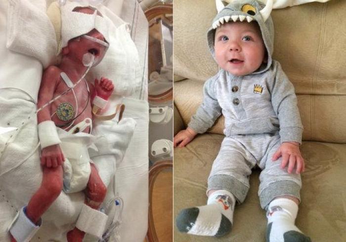 Estos peluches están cambiando la vida de los bebés prematuros