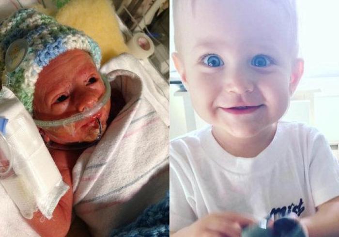 Estos peluches están cambiando la vida de los bebés prematuros