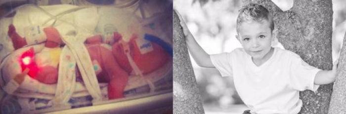 Estos peluches están cambiando la vida de los bebés prematuros