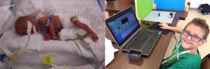 Estos peluches están cambiando la vida de los bebés prematuros