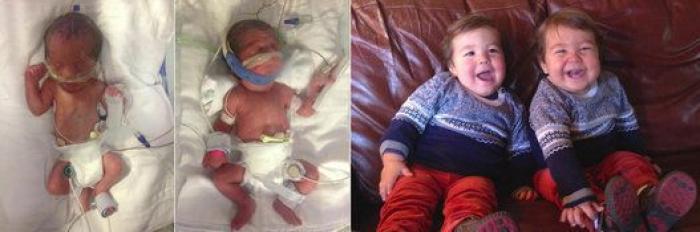 Estos peluches están cambiando la vida de los bebés prematuros