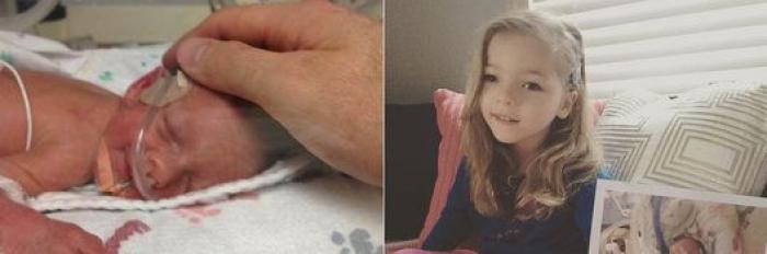 Estos peluches están cambiando la vida de los bebés prematuros