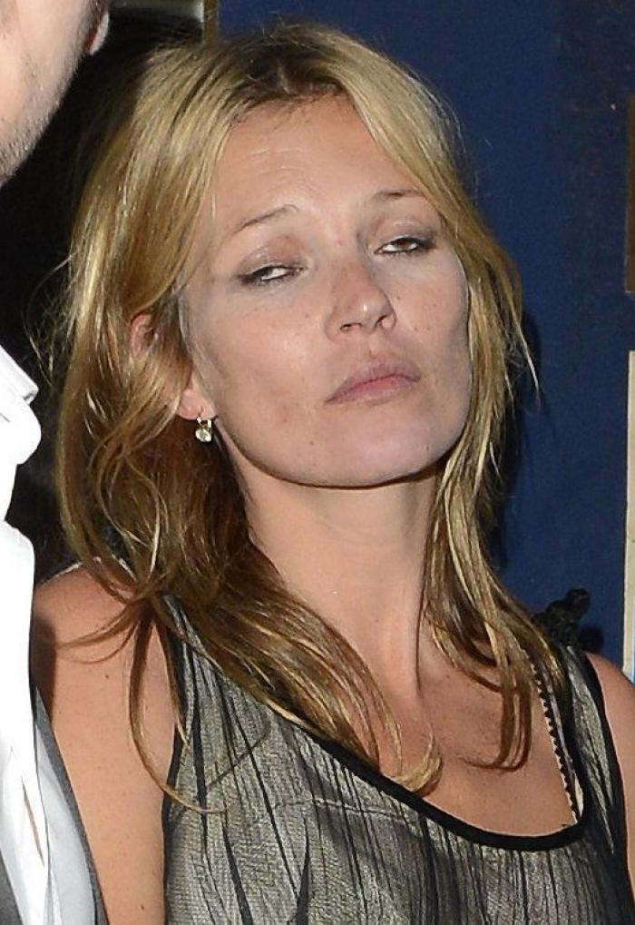 Las peores fotos de los famosos: imágenes de celebridades que nunca debieron ver la luz (FOTOS)