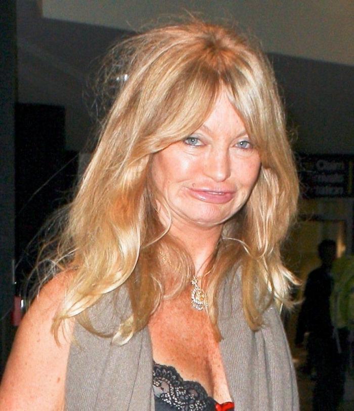 Las peores fotos de los famosos: imágenes de celebridades que nunca debieron ver la luz (FOTOS)