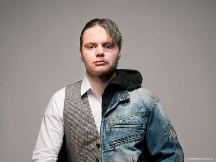 Las drogas no se dejan de un día para otro, como dice Miguel Bosé