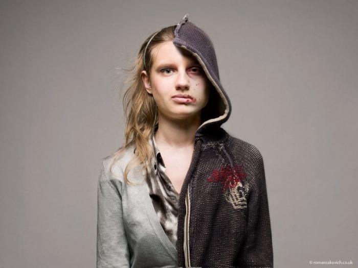 Las drogas no se dejan de un día para otro, como dice Miguel Bosé