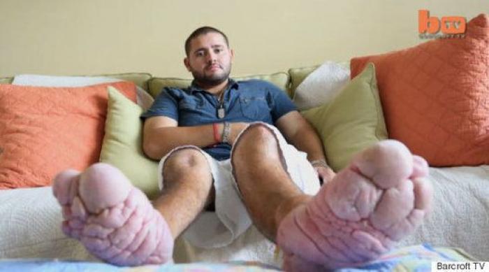 La realidad de la fibromialgia: una enfermedad que va más allá del dolor