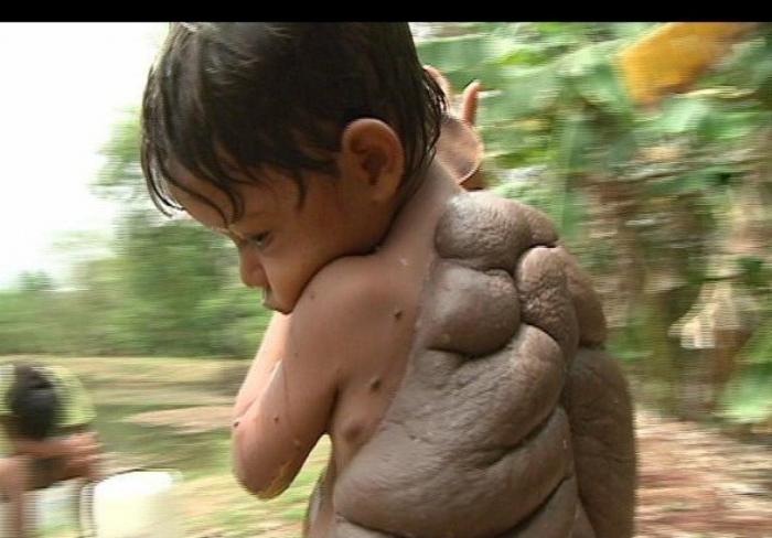 La realidad de la fibromialgia: una enfermedad que va más allá del dolor