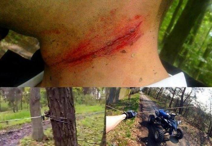 El acusado de atropellar al ciclista Alejandro Valverde y a dos compañeros fue guardia civil