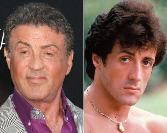 Qué pueden hacer los padres si sus hijos quieren someterse a una cirugía estética