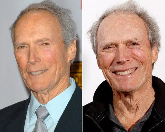 Qué pueden hacer los padres si sus hijos quieren someterse a una cirugía estética