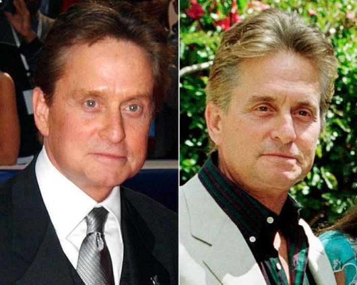 Qué pueden hacer los padres si sus hijos quieren someterse a una cirugía estética