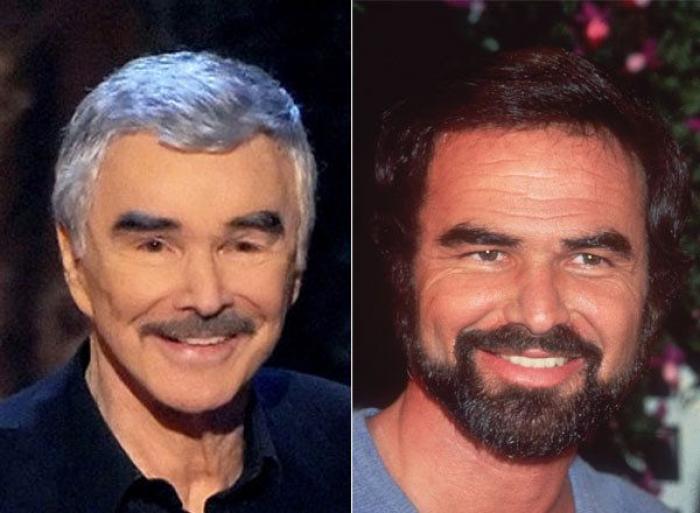 Qué pueden hacer los padres si sus hijos quieren someterse a una cirugía estética