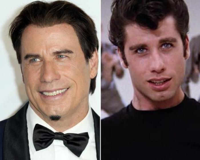 Qué pueden hacer los padres si sus hijos quieren someterse a una cirugía estética