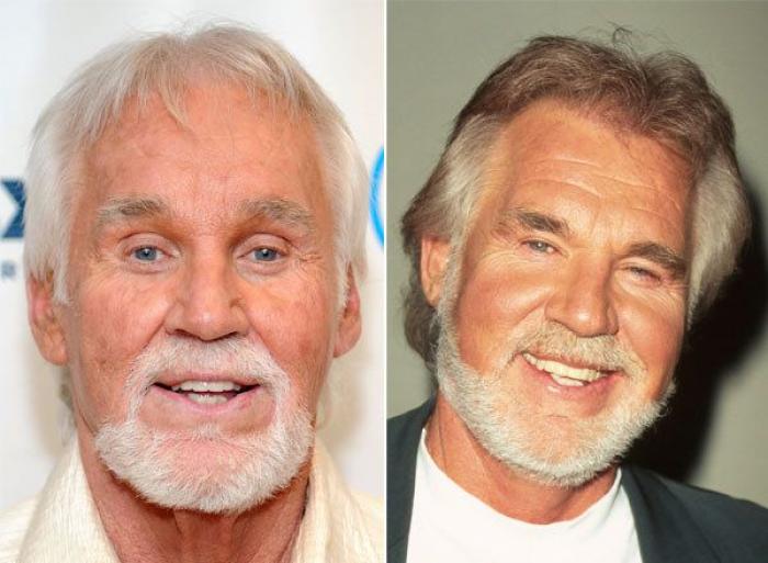 Qué pueden hacer los padres si sus hijos quieren someterse a una cirugía estética