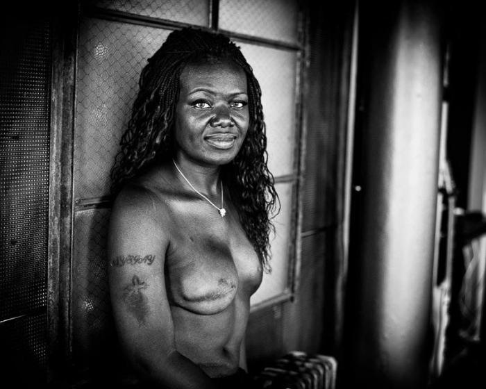 Proyecto Cicatriz: 12 fotos de mujeres reales tras vencer el cáncer de mama (FOTOS)