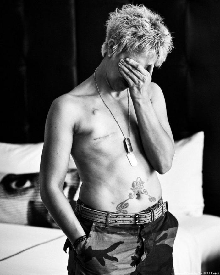 Proyecto Cicatriz: 12 fotos de mujeres reales tras vencer el cáncer de mama (FOTOS)