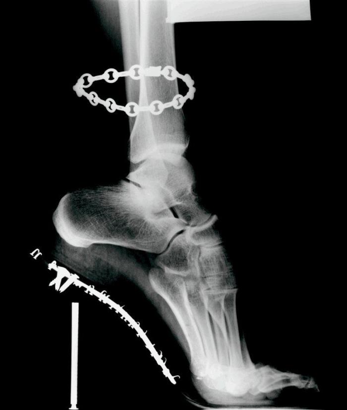 Muere en París a los 94 años el fotógrafo William Klein