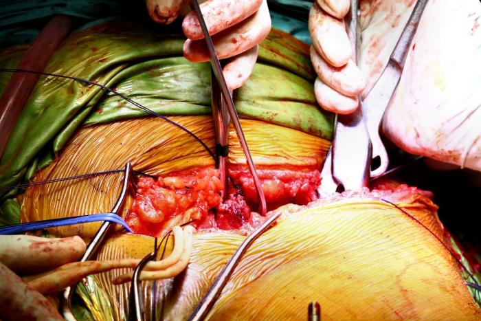 Un neurocientífico descubre que es un psicópata en potencia