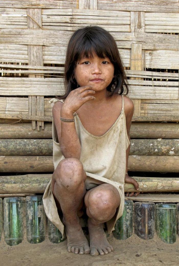 Vosotros, la esperanza