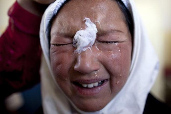 Leishmaniasis, la enfermedad que se está cebando con los refugiados de Oriente Medio