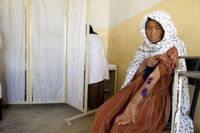 Leishmaniasis, la enfermedad que se está cebando con los refugiados de Oriente Medio