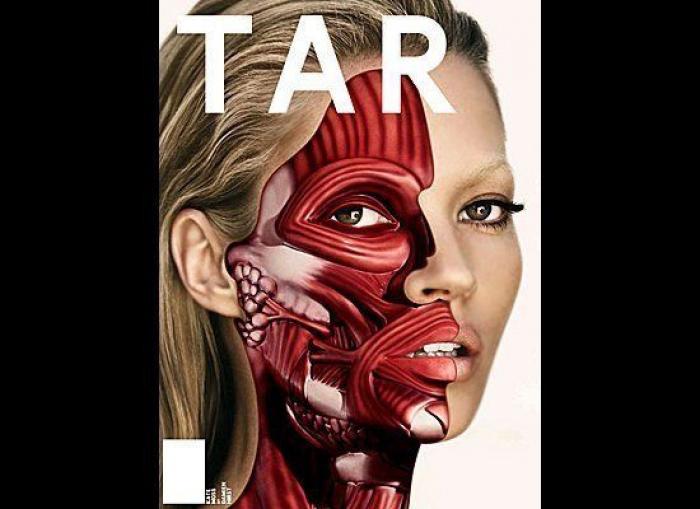 Lila Grace, hija de Kate Moss, aplaudida por desfilar con su bomba de insulina