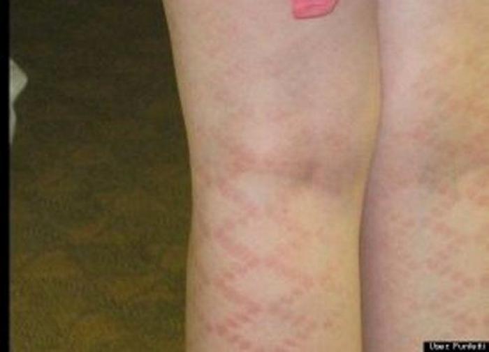 9 alimentos que deberías tomar este verano para la piel