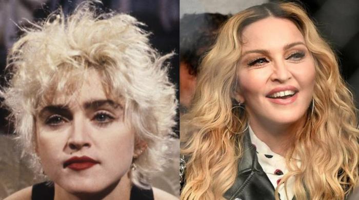 Inma Campano, de 'La isla de las tentaciones 2', reaparece desfigurada