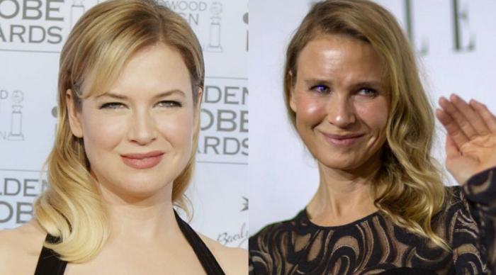 Inma Campano, de 'La isla de las tentaciones 2', reaparece desfigurada