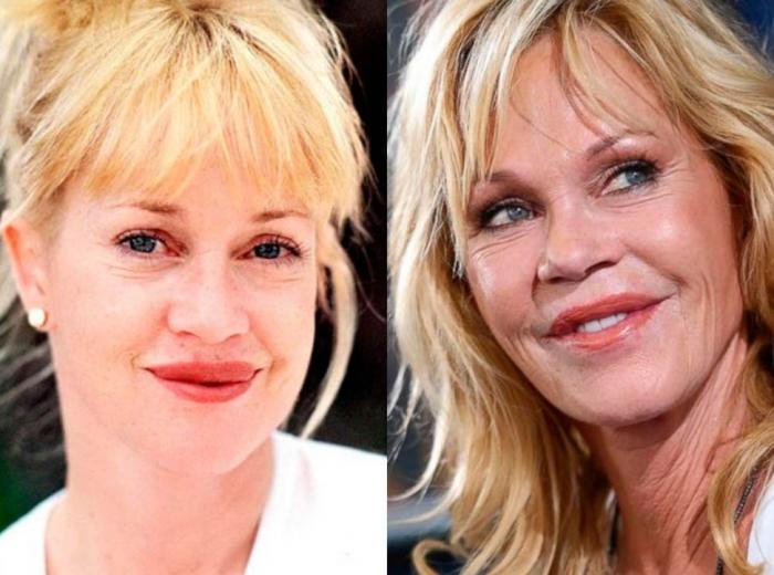 Inma Campano, de 'La isla de las tentaciones 2', reaparece desfigurada