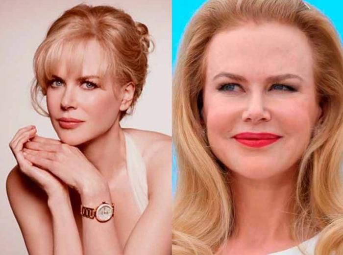 Inma Campano, de 'La isla de las tentaciones 2', reaparece desfigurada