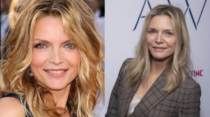 Inma Campano, de 'La isla de las tentaciones 2', reaparece desfigurada