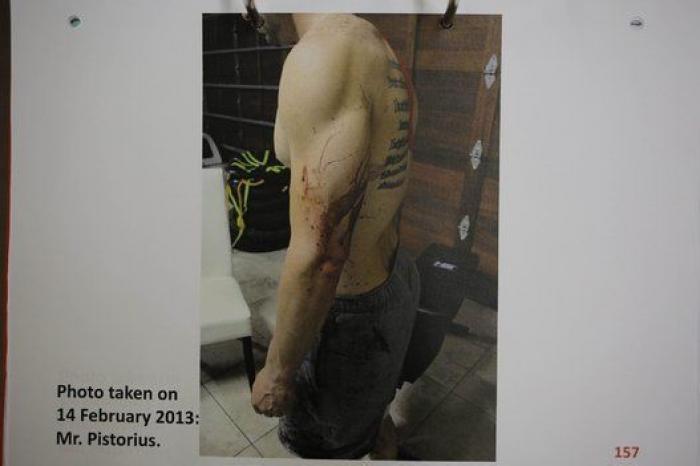 Salen a la luz las fotografías que incriminan a Pistorius