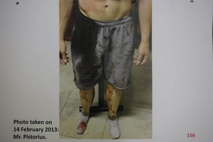 Salen a la luz las fotografías que incriminan a Pistorius