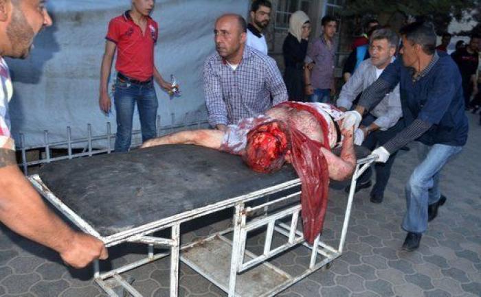 Al menos 27 muertos por un ataque sobre un hospital asistido por MSF en Alepo