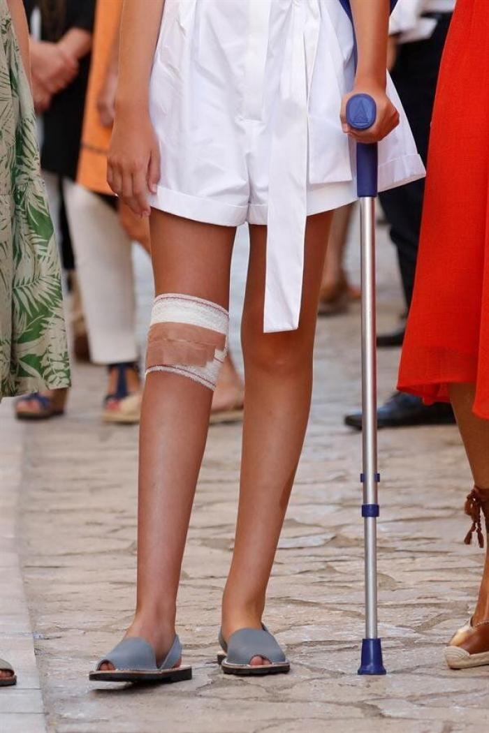 Varios enfermeros, extrañados con el vendaje de la infanta Sofía en estas fotos