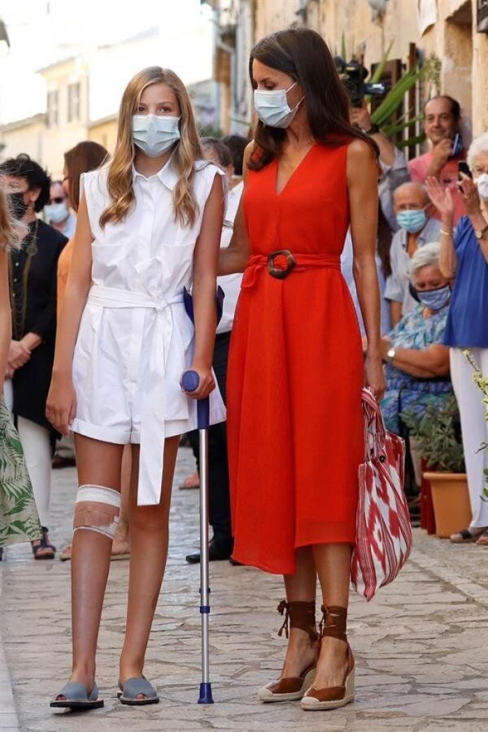 Varios enfermeros, extrañados con el vendaje de la infanta Sofía en estas fotos