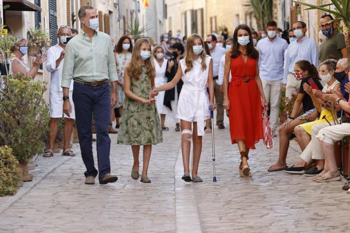 Varios enfermeros, extrañados con el vendaje de la infanta Sofía en estas fotos