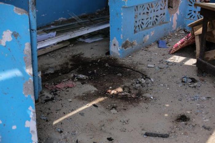 Yemen, las dos caras de una guerra