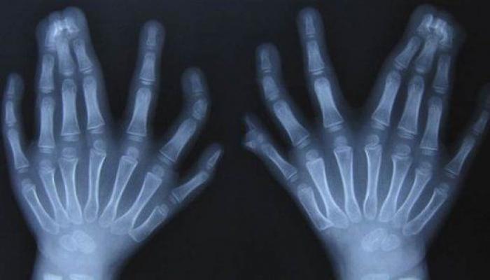 7 cosas que son más fáciles y más difíciles que ganar el Gordo