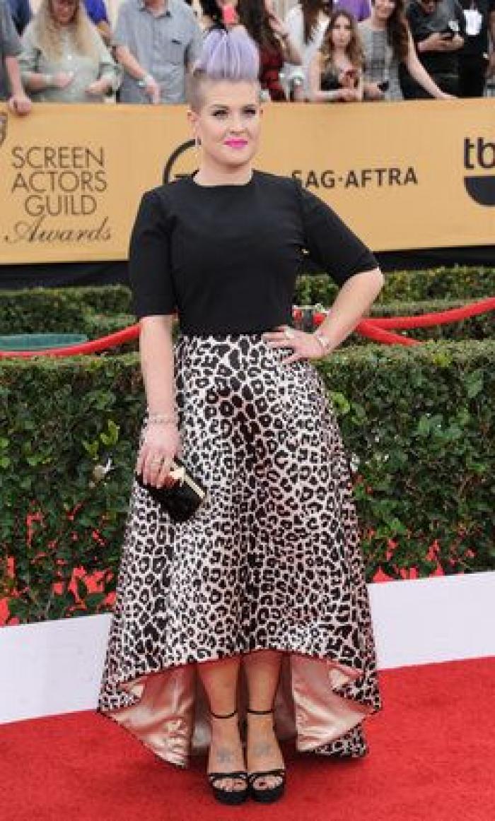 SAG Awards 2015: El patinazo de Naomi Watts por culpa del vestido de Emma Stone (VÍDEO)